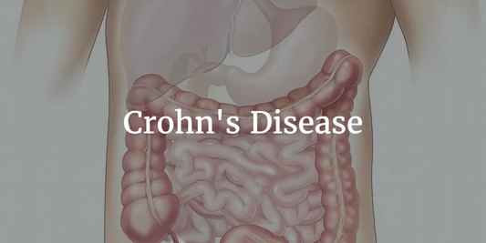 NATURAL WAYS TO REDUCE CROHN’S SYMPTOMS